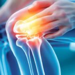 knees, osteoarthritis, body