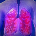 upper body, lung, copd, disease, doctor, finding, medicine, health check, health, examination, heal, pension, ill, investigate, therapy, ultrasound, healthy, lung, lung, lung, lung, lung, copd, copd