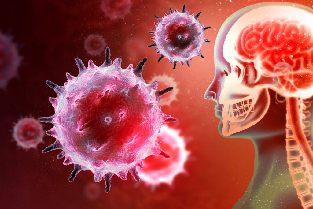 Virale Meningitis Wie Lange Krank medizin.studio