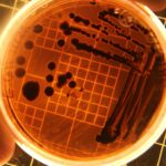 Close-up of bacteria colonies in a petri dish under laboratory conditions.