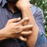 A man in a blue shirt scratching his arm outdoors, highlighting skin irritation.