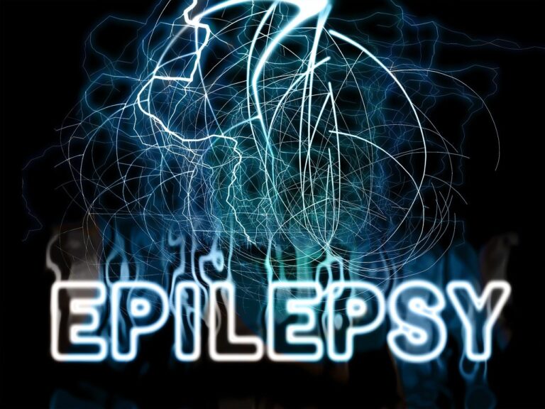 fire, explosion, disease, spasm, seizure, mentally, psychic, head, lightning strike, lightning bolt, pain, pains, electrostatic, seem to be, discharge, medical, energy, power, passed out, electricity, strength, lightning, voltage, stress, state, epilepsy, body, person, people, torment, epilepsy, epilepsy, epilepsy, epilepsy, epilepsy