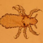 larva, lice, insect, parasite, lice, lice, lice, lice, lice, parasite