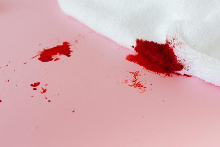 A white towel with red stains on a pink surface, depicting a messy spill.