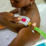 A healthcare professional measures a child's arm using MUAC tape for malnutrition assessment.