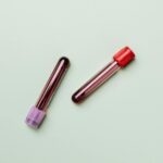 Blood samples in test tubes on a light background, ideal for medical and laboratory themes.