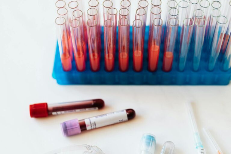 Sichelzellenanämie From above of plastic stand with test tubes of blood placed on white surface near vials of blood and syringe