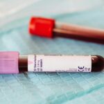 Close-up view of blood sample vials on a medical table, ideal for healthcare and laboratory themes.